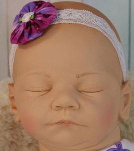 David-Kewy-22-mixed-limb-girl-thumb